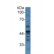 Western blot analysis of Human Placenta lysate, using Human PAI2 Antibody (3 µg/ml) and HRP-conjugated Goat Anti-Rabbit antibody (<a href="https://www.abbexa.com/index.php?route=product/search&amp;search=abx400043" target="_blank">abx400043</a>, 0.2 µg/ml).