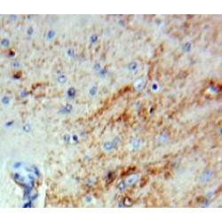 Plasminogen Activator Inhibitor 2 (PAI2) Antibody