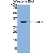 Western blot analysis of the recombinant protein.