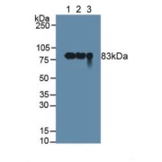 Western blot analysis of (1) Human Milk, (2) Human Urine and (3) Human Saliva.