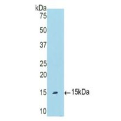 Polymeric Immunoglobulin Receptor (PIGR) Antibody