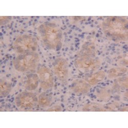 Polymeric Immunoglobulin Receptor (PIGR) Antibody