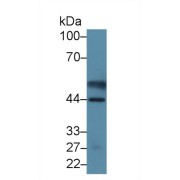 Western blot analysis of the recombinant protein.