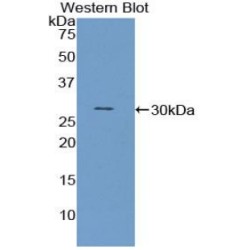 Pyruvate Dehydrogenase Phosphatase (PDP) Antibody