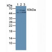 Western blot analysis of (1) Human PC-3 Cells, (2) Human Liver Tissue and (3) Mouse Kidney Tissue.