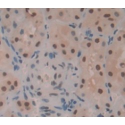 RAR Related Orphan Receptor Alpha (RORa) Antibody