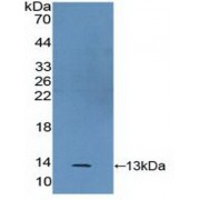 Western blot analysis of recombinant Human S100A2.