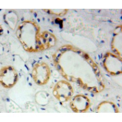 S100 Calcium Binding Protein A2 (S100A2) Antibody