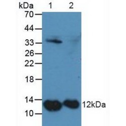 S100 Calcium Binding Protein A4 (S100A4) Antibody