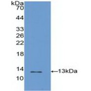 Western blot analysis of recombinant Human S100A4.