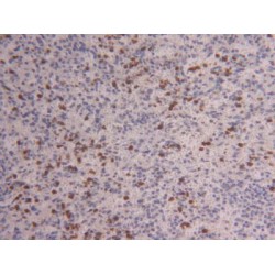 S100 Calcium Binding Protein A4 (S100A4) Antibody