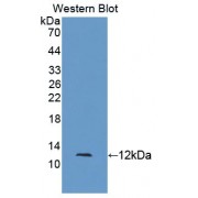 Western blot analysis of the recombinant protein.