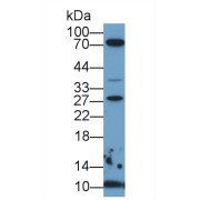 Western blot analysis of Human HeLa cell lysate, using Mouse S100A6 Antibody (1 µg/ml) and HRP-conjugated Goat Anti-Rabbit antibody (<a href="https://www.abbexa.com/index.php?route=product/search&amp;search=abx400043" target="_blank">abx400043</a>, 0.2 µg/ml).