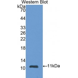 S100 Calcium Binding Protein A6 (S100A6) Antibody