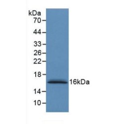 S100 Calcium Binding Protein A6 (S100A6) Antibody