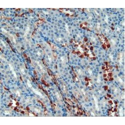 S100 Calcium Binding Protein A6 (S100A6) Antibody