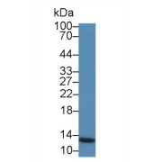 Western blot analysis of Mouse Skin lysate, using Mouse S100A7 Antibody (5 µg/ml) and HRP-conjugated Goat Anti-Rabbit antibody (<a href="https://www.abbexa.com/index.php?route=product/search&amp;search=abx400043" target="_blank">abx400043</a>, 0.2 µg/ml).