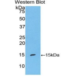 S100 Calcium Binding Protein A7 (S100A7) Antibody