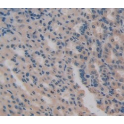 S100 Calcium Binding Protein A7 (S100A7) Antibody