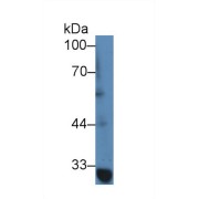 Western blot analysis of Human jurkat cell lysate, using Mouse TRAF1 Antibody (2 µg/ml) and HRP-conjugated Goat Anti-Rabbit antibody (<a href="https://www.abbexa.com/index.php?route=product/search&amp;search=abx400043" target="_blank">abx400043</a>, 0.2 µg/ml).