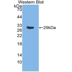 TNF Receptor Associated Factor 1 (TRAF1) Antibody