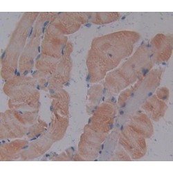 Troponin I Type 1, Slow Skeletal (TNNI1) Antibody