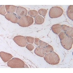 Troponin I Type 1, Slow Skeletal (TNNI1) Antibody