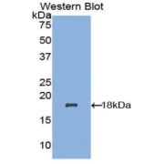 Western blot analysis of the recombinant protein.