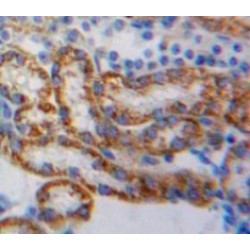 Acyl Carrier Protein, Mitochondrial (ACP) Antibody