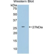 Western blot analysis of the recombinant protein.