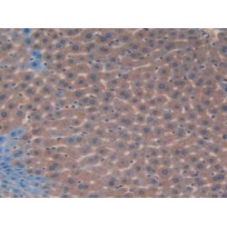 Adenomatosis Polyposis Coli Protein (APC) Antibody