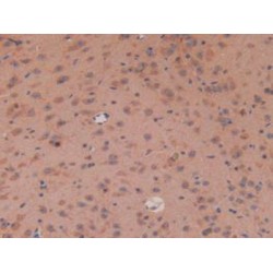 Adenomatosis Polyposis Coli Protein (APC) Antibody