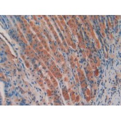 Adenomatosis Polyposis Coli Protein (APC) Antibody