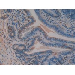 Adenomatosis Polyposis Coli Protein (APC) Antibody