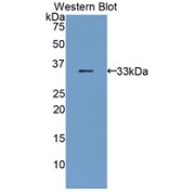 Western blot analysis of the recombinant protein.