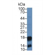 Western blot analysis of Mouse Spleen lysate, using Mouse CAMP Antibody (2 µg/ml) and HRP-conjugated Goat Anti-Rabbit antibody (<a href="https://www.abbexa.com/index.php?route=product/search&amp;search=abx400043" target="_blank">abx400043</a>, 0.2 µg/ml).