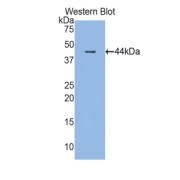 Western blot analysis of the recombinant protein.