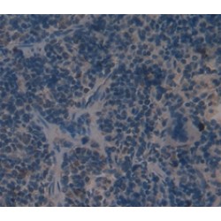 Cathelicidin Antimicrobial Peptide (CAMP) Antibody