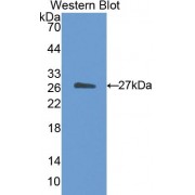 Western blot analysis of the recombinant protein.