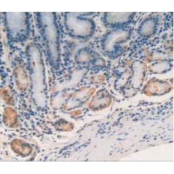 DNA Damage Inducible Transcript 3 (DDIT3) Antibody