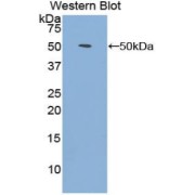 Western blot analysis of the recombinant protein.