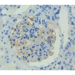 Fibroblast Growth Factor 1, Acidic / AFGF (FGF1) Antibody