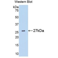 Glutathione S Transferase Alpha 1 (GSTa1) Antibody