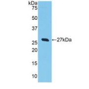 Western blot analysis of recombinant Human GSTa2.