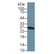 Western blot analysis of Human Liver lysate, using Human GSTa3 Antibody (2 µg/ml) and HRP-conjugated Goat Anti-Rabbit antibody (<a href="https://www.abbexa.com/index.php?route=product/search&amp;search=abx400043" target="_blank">abx400043</a>, 0.2 µg/ml).