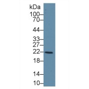 Western blot analysis of Human Liver lysate, using Human GSTk1 Antibody (1 µg/ml) and HRP-conjugated Goat Anti-Rabbit antibody (<a href="https://www.abbexa.com/index.php?route=product/search&amp;search=abx400043" target="_blank">abx400043</a>, 0.2 µg/ml).