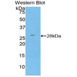 Glutathione S Transferase Kappa 1 (GSTk1) Antibody