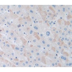 Glutathione S Transferase Kappa 1 (GSTk1) Antibody