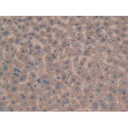 Glutathione S Transferase Kappa 1 (GSTk1) Antibody