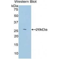 Glutathione S Transferase Kappa 1 (GSTk1) Antibody